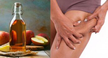 Sconfiggere la cellulite: come fare con l’aceto di mele