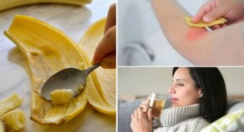 Buccia di banana: utilizzatela per una settimana, vedrete quanti benefici!