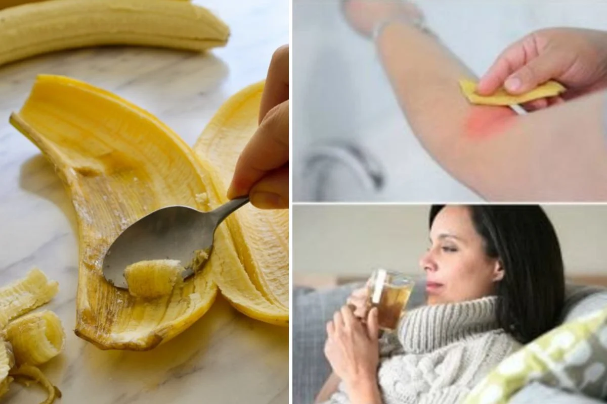 Buccia di banana: utilizzatela per una settimana, vedrete quanti benefici!