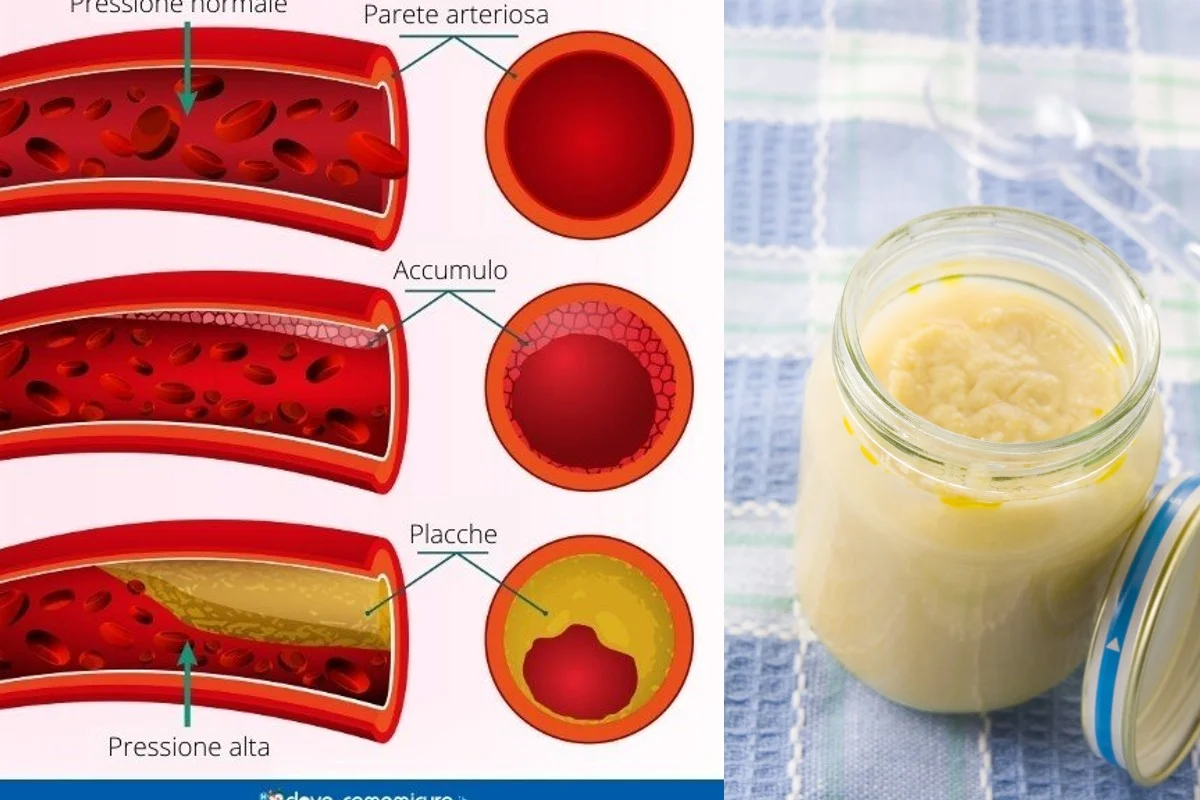 Il potente antibiotico naturale, che abbassa il colesterolo e fa bene alla pressione