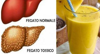 Bevanda alla banana e curcuma: abbassa glicemia e colesterolo, disintossica il fegato e reni