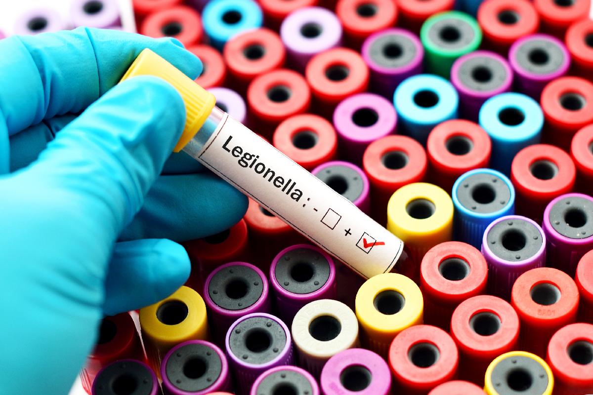 Legionella