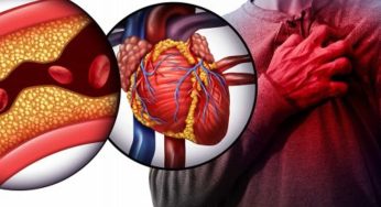 5 super cibi che aiutano a pulire le arterie e ad abbassare il colesterolo