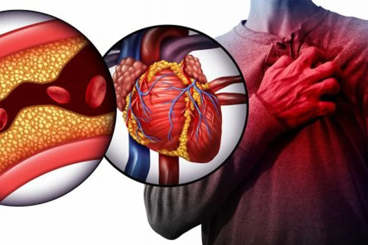 5 super cibi che aiutano a pulire le arterie e ad abbassare il colesterolo