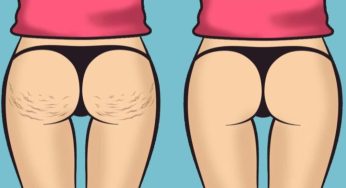 La dieta anti cellulite che brucia il grasso in una sola settimana! Con menù